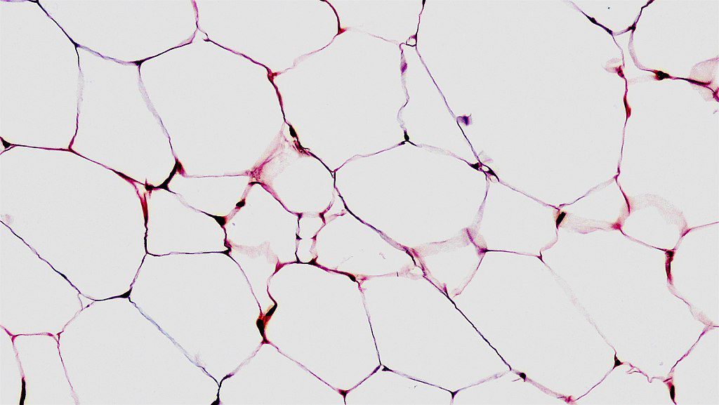 microscopische afbeelding van vetcellen
